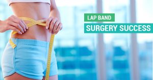 Lap-Band-Surgery-Success