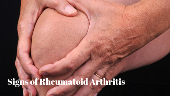 Signs of Rheumatoid Arthritis