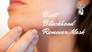 Best Blackhead Remover Mask