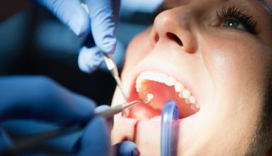 Dental filling