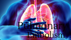 Pulmonary