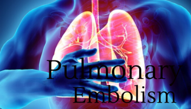 Pulmonary