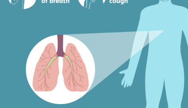Sign Of COPD