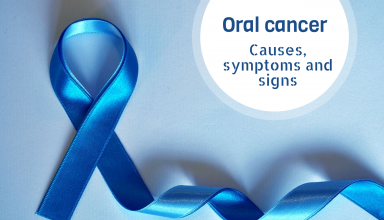 Oral cancer_ Causes, symptoms and signs