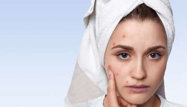 Skin Problems
