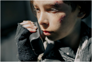 Personal Injury Case