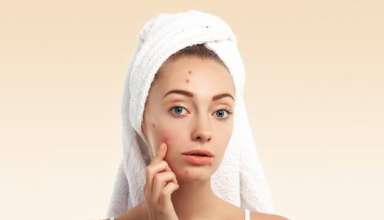 Oily Skin