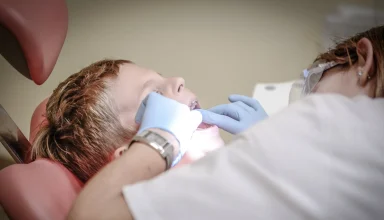 Cost of a Perfect Smile