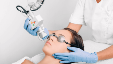 Skin Tightening Laser