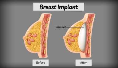 Breast Implant Size and Shape