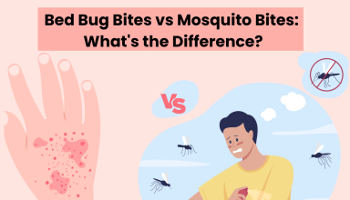 Bed Bug Bites vs Mosquito Bites