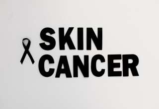 Skin Cancer